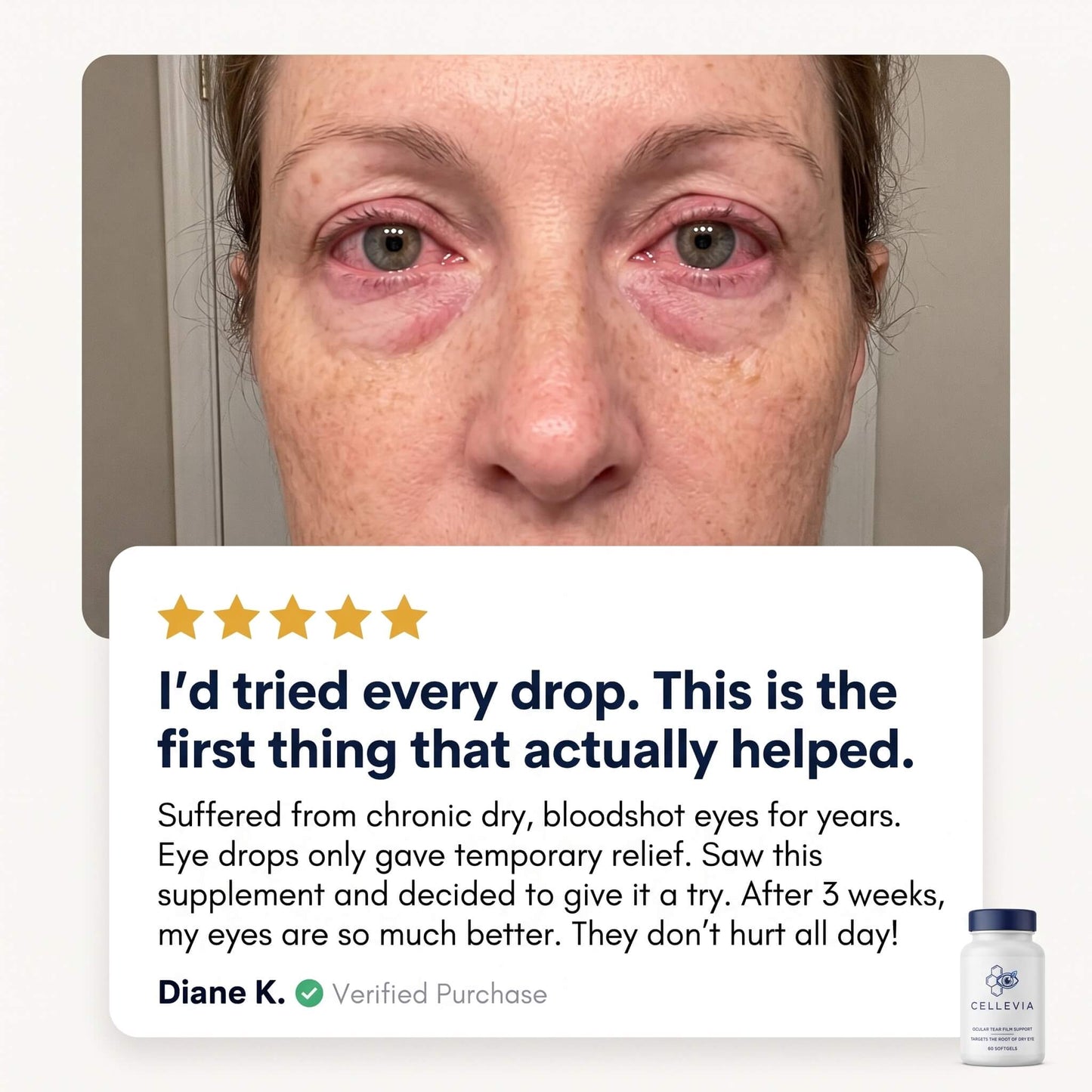 Cellevia™ - Fight Dry Eye From Inside Out